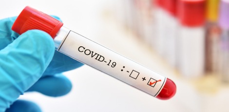 Blood sample tube positive with COVID-19 or novel coronavirus 2019 found in Wuhan, China