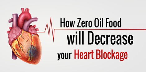 If you consume foods with unhealthy fats etc frequently, you can get these serious health issues!!