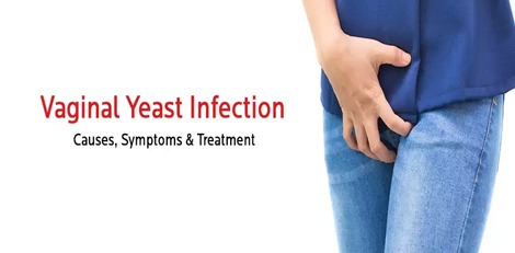 Women can get yeast infection by these surprising habits, take care!!