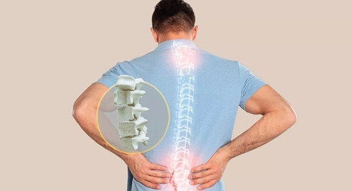 Does Bone Strength Decrease After 30? Dr. Arun Kumar Explains the Truth