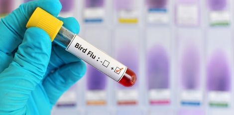 Bird Flu: Symptoms, Treatment, and Prevention