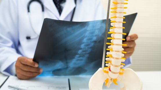 Simple Habits That Can Help Keep Your Bones Strong